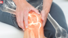 Know Causes of Knee Pain And How To Get Relief