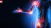 Major Causes of Shoulder Pain And Arm Pain